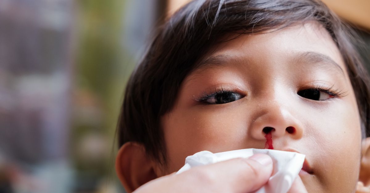 Chảy máu cam mùa hanh khô