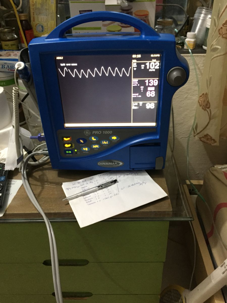 moniter GE của Mỹ