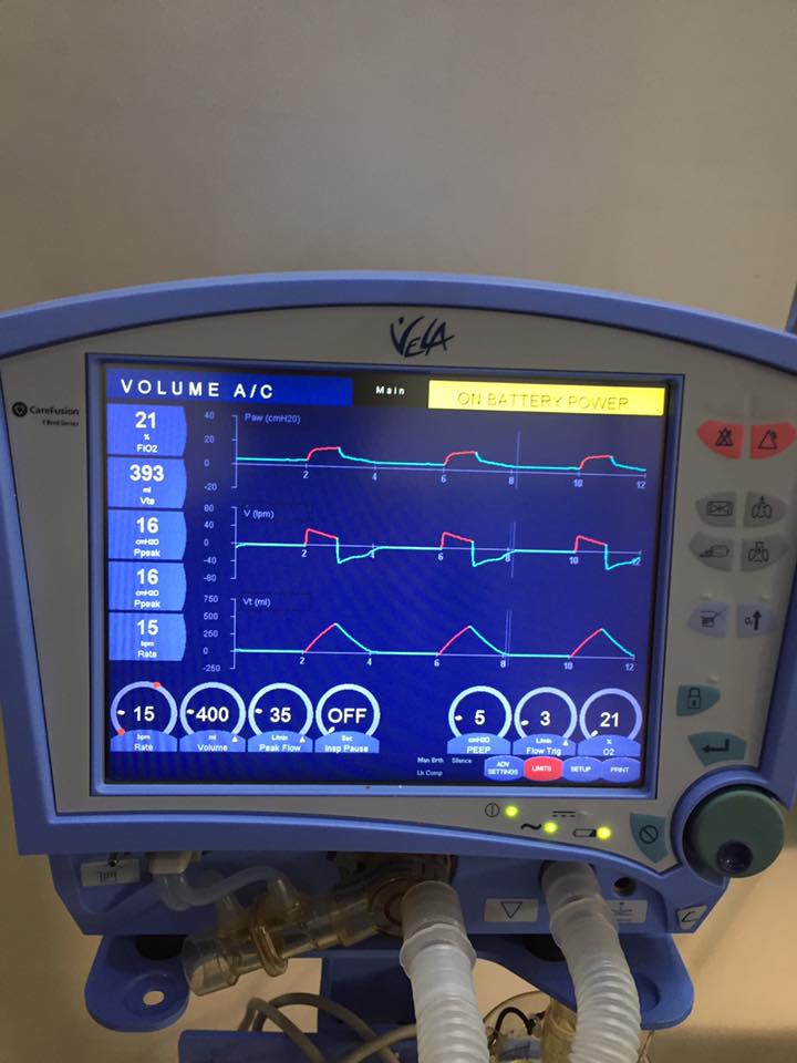máy thở vela cho thuê